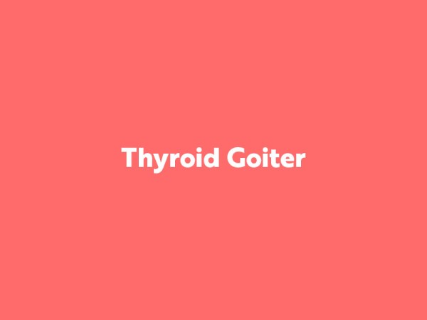 Thyroid Goiter